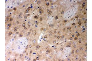 Anti- PP2A-alpha Picoband antibody, IHC(P) IHC(P): Rat Brain Tissue (PPP2CA antibody  (AA 1-309))