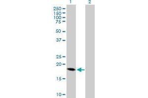 Western Blot analysis of CRH expression in transfected 293T cell line by CRH MaxPab polyclonal antibody. (CRH antibody  (AA 1-196))