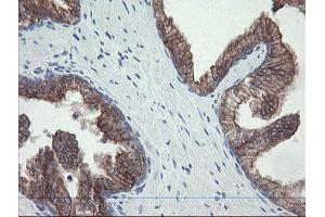 Image no. 1 for anti-Prefoldin Subunit 3 (PFDN3) antibody (ABIN1501702) (VBP1 antibody)