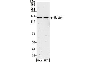 anti-RAPTOR (RAPTOR) (AA 1-50) antibody