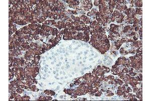 Image no. 4 for anti-Carboxypeptidase A2 (Pancreatic) (CPA2) antibody (ABIN1497594) (Carboxypeptidase A2 antibody)