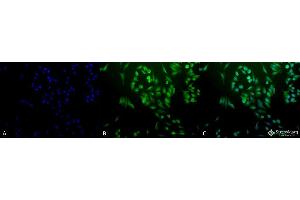 Immunocytochemistry/Immunofluorescence analysis using Rabbit Anti-Ubiquitin Polyclonal Antibody . (Ubiquitin antibody  (Atto 488))