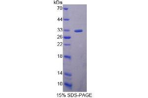 SDS-PAGE (SDS) image for Ubiquitin-Conjugating Enzyme E2S (UBE2S) (AA 1-223) protein (His tag) (ABIN4990269)