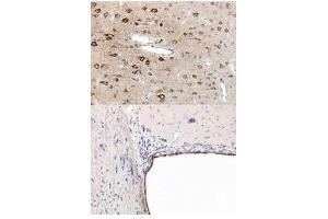 Immunohistochemistry (IHC) image for anti-Peroxisome Proliferator-Activated Receptor alpha (PPARA) (N-Term) antibody (ABIN105798) (PPARA antibody  (N-Term))
