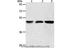 Western blot analysis of Human brain malignant glioma and human fetal kidney tissue, A172 cell, using ACOT9 Polyclonal Antibody at dilution of 1:600 (ACOT9 antibody)