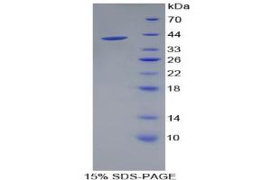 SDS-PAGE analysis of Rat Cadherin 5 Protein.