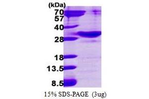 SDS-PAGE (SDS) image for RAB34, Member RAS Oncogene Family (RAB34) (AA 1-259) protein (His tag) (ABIN667981)
