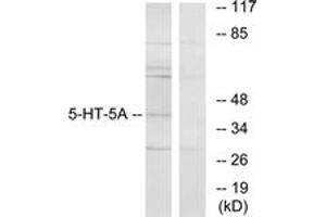 Western Blotting (WB) image for anti-Serotonin Receptor 5A (HTR5A) (AA 211-260) antibody (ABIN2889849) (Serotonin Receptor 5A antibody  (AA 211-260))