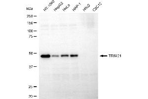 Western blotting analysis using TRIM21 antibody (ABIN7800627).
