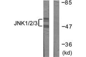 Western blot analysis of extracts from 293 cells, treated with UV 5', using JNK1/2/3 (Ab-183/185) Antibody.