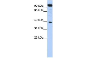WB Suggested Anti-HOXB2 Antibody Titration:  0. (HOXB2 antibody  (N-Term))