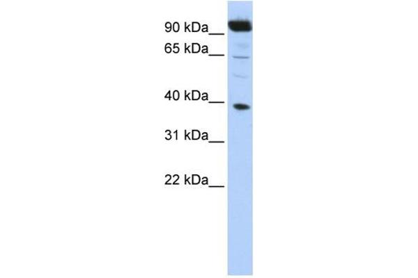 HOXB2 Antikörper  (N-Term)