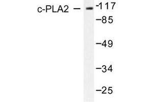 Image no. 2 for anti-Phospholipase A2, Group IVB (Cytosolic) (PLA2G4B) antibody (ABIN271921) (PLA2G4B antibody)