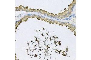 Immunohistochemical analysis of RNase 13 staining in human prostate formalin fixed paraffin embedded tissue section. (RNASE13 antibody)