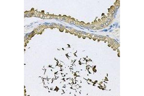 RNASE13 antibody
