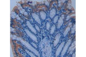 Used in DAB staining on fromalin fixed paraffin- embedded intestine tissue (ENPP7 antibody  (AA 22-439))
