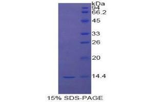 SDS-PAGE (SDS) image for Signal Transducer and Activator of Transcription 3 (Acute-Phase Response Factor) (STAT3) (AA 563-670) protein (His tag) (ABIN1171369)