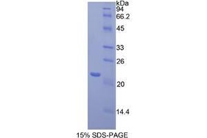 SDS-PAGE analysis of Mouse Toll Like Receptor 3 Protein.