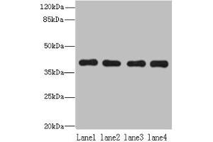 Western blot All lanes: NUDT9 antibody at 8 μg/mL Lane 1: Raji whole cell lysate Lane 2: Jurkat whole cell lysate Lane 3: Mouse kidney tissue Lane 4: Hela whole cell lysate Secondary Goat polyclonal to rabbit IgG at 1/10000 dilution Predicted band size: 40, 34 kDa Observed band size: 40 kDa (NUDT9 antibody  (AA 47-350))