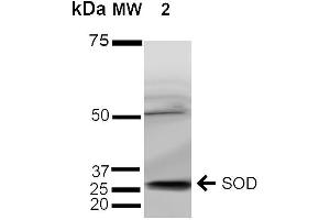 Western blot analysis of Human Cervical Cancer cell lysates (HeLa) showing detection of ~35 kDa SOD (EC) protein using Rabbit Anti-SOD (EC) Polyclonal Antibody . (SOD3 antibody  (AA 227-236))