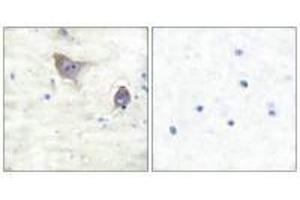 Immunohistochemical analysis of paraffin-embedded human brain tissue using Synuclein β antibody. (beta Synuclein antibody)