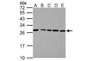 Western Blotting (WB) image for anti-High Mobility Group Box 1 (HMGB1) antibody (ABIN2854997)