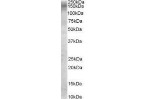 Image no. 2 for anti-TBC1 Domain Family, Member 4 (TBC1D4) (Internal Region) antibody (ABIN374867)