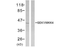 Western blot analysis of extracts from NIH/3T3 cells using SEK1/MKK4 (Ab-80) antibody (E021132). (MAP2K4 antibody)