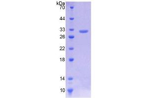 SDS-PAGE (SDS) image for Kruppel-Like Factor 5 (Intestinal) (KLF5) (AA 216-457) protein (His tag) (ABIN6236780) (KLF5 Protein (AA 216-457) (His tag))