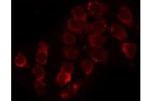 ABIN6279061 staining HepG2 by IF/ICC. (ACAD11 antibody  (Internal Region))