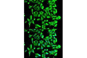 Immunofluorescence analysis of U2OS cells using HSP90AB1 antibody. (HSP90AB1 antibody)
