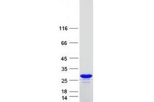 Western Blotting (WB) image for Parkinson Protein 7 (PARK7) (Transcript Variant 1) protein (Myc-DYKDDDDK Tag) (ABIN2719515)
