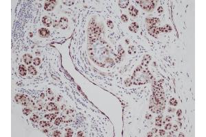 Immunohistochemistry (IHC) image for anti-Fibroblast Growth Factor 2 (Basic) (FGF2) antibody (Biotin) (ABIN2473614) (FGF2 antibody  (Biotin))