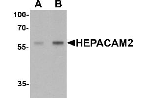 Western Blotting (WB) image for anti-HEPACAM Family Member 2 (HEPACAM2) (C-Term) antibody (ABIN1077405) (HEPACAM2 antibody  (C-Term))
