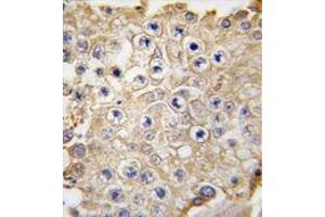 Formalin-fixed and paraffin-embedded human testis tissue reacted with APPBP1 antibody (C-term) , which was peroxidase-conjugated to the secondary antibody, followed by DAB staining. (NAE1 antibody  (C-Term))