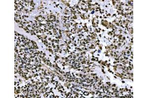 IHC analysis of THAP11 using anti-THAP11 antibody (ABIN7599230). (THAP11 antibody  (AA 1-294))