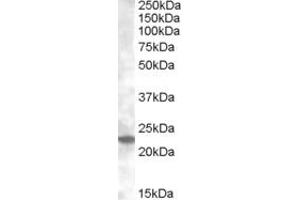 Western Blotting (WB) image for anti-RAB17, Member RAS Oncogene Family (RAB17) (AA 102-115) antibody (ABIN490469) (RAB17 antibody  (AA 102-115))