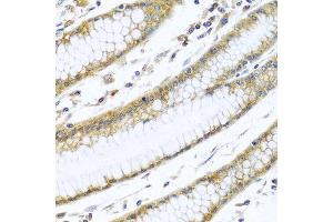 Immunohistochemistry of paraffin-embedded human stomach using GNAI3 antibody at dilution of 1:100 (40x lens).