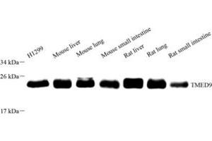 Western blot analysis of TMED9 (ABIN7075988),at dilution of 1: 4000 (TMED9 antibody)