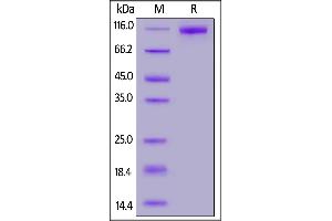 SARS-CoV-2 Spike S1, His Tag (B. (SARS-CoV-2 Spike S1 Protein (B.1.1.529 - Omicron) (His tag))