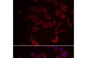 Immunofluorescence analysis of MCF-7 cells using RPL11 Polyclonal Antibody (RPL11 antibody)