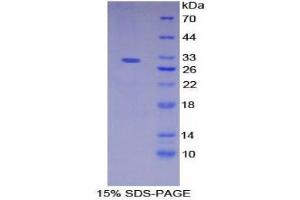 SDS-PAGE (SDS) image for Nicastrin (NCSTN) (AA 420-655) protein (His tag) (ABIN2126089)