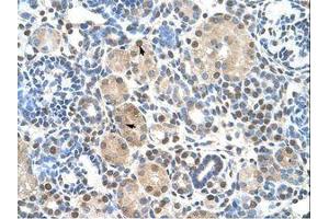 Image no. 1 for anti-Zinc Finger Protein 274 (ZNF274) (AA 87-136) antibody (ABIN203353) (ZNF274 antibody  (AA 87-136))
