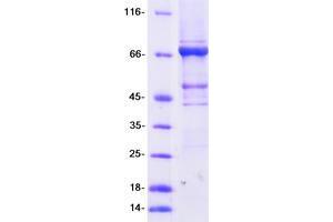 Validation with Western Blot (TRMT2A Protein (Transcript Variant 1) (Myc-DYKDDDDK Tag))