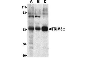 Western Blotting (WB) image for anti-Tripartite Motif Containing 5 (TRIM5) (Middle Region 2) antibody (ABIN1031206) (TRIM5 antibody  (Middle Region 2))