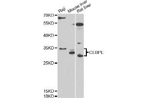 Western blot analysis of extracts of various cell lines, using CEBPE antibody (ABIN6291284) at 1:1000 dilution. (CEBPE antibody)