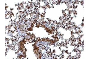 IHC-P Image BCL7A antibody [C2C3], C-term detects BCL7A protein at nucleus on mouse lung by immunohistochemical analysis. (BCL7A antibody  (C-Term))