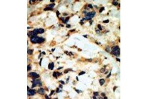 Image no. 1 for anti-serum/glucocorticoid Regulated Kinase 2 (SGK2) (C-Term) antibody (ABIN360349) (SGK2 antibody  (C-Term))