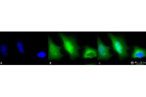 Immunocytochemistry/Immunofluorescence analysis using Rabbit Anti-SOD (Cu/Zn) Polyclonal Antibody . (SOD1 antibody  (FITC))