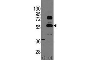 Western blot analysis of SOX9 antibody and 293 cell lysate (2 ug/lane) either nontransfected (Lane 1) or transiently transfected with the SOX9 gene (2). (SOX9 antibody  (AA 41-70))
